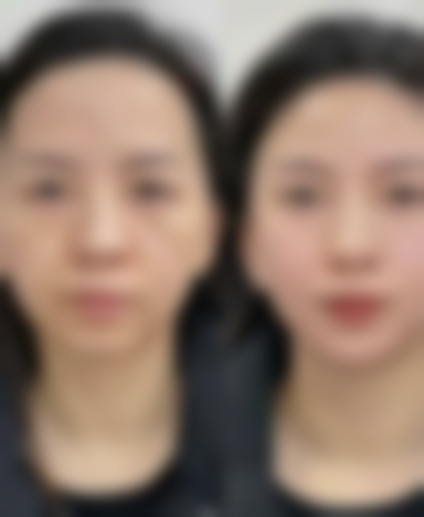 成都欣奕医疗美容诊所求美者反馈