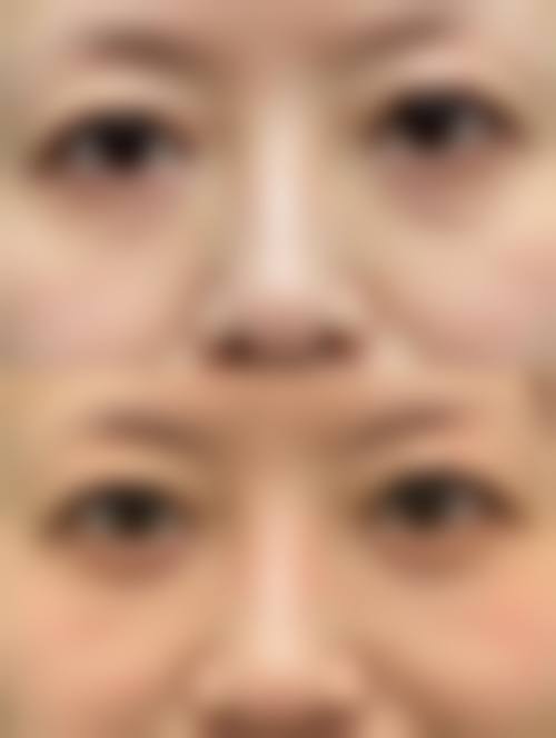 兰州市长青佳黛医疗美容门诊部求美者反馈