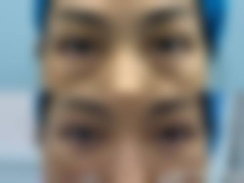 玖美(枣庄日照徐州)整形连锁求美者反馈