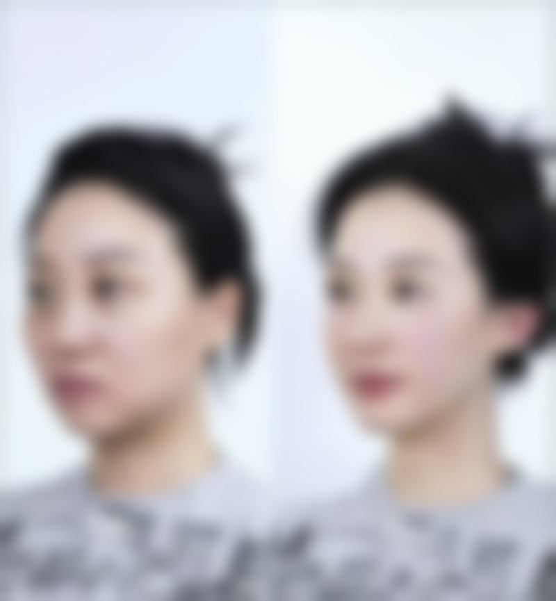 温州德米尔医疗美容求美者反馈