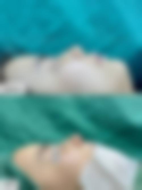 濮阳张大夫医疗整形价格收费