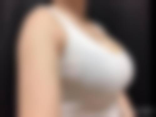 北京苏明山医疗美容诊所求美者反馈