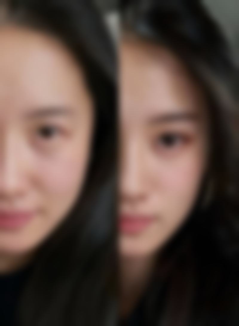 濮阳张大夫医疗整形求美者反馈