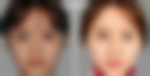 台灣全美整形診所求美者反馈