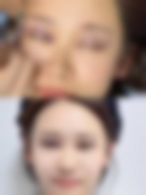 北京柏丽整形医疗美容门诊部特色项目及技术优势