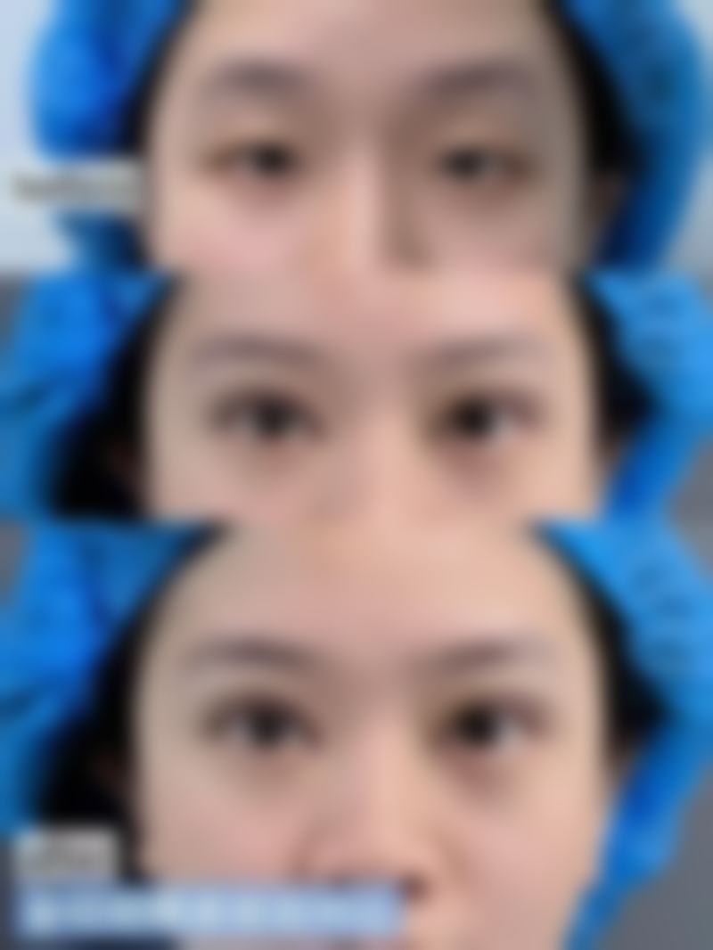 北京柏丽整形医疗美容门诊部求美者反馈