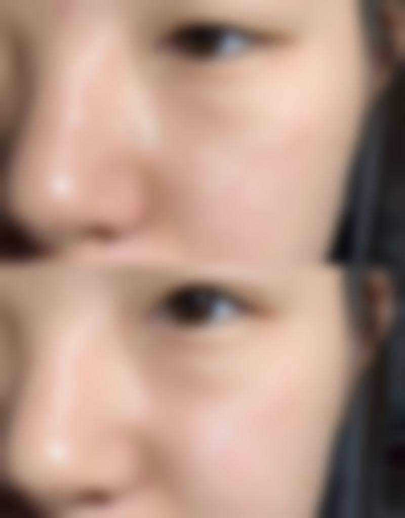 福州艾丽莎整形美容医院求美者反馈