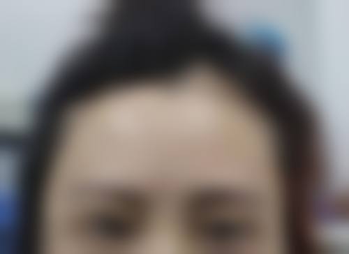 济南瑞丽诗植发医院特色项目及技术优势