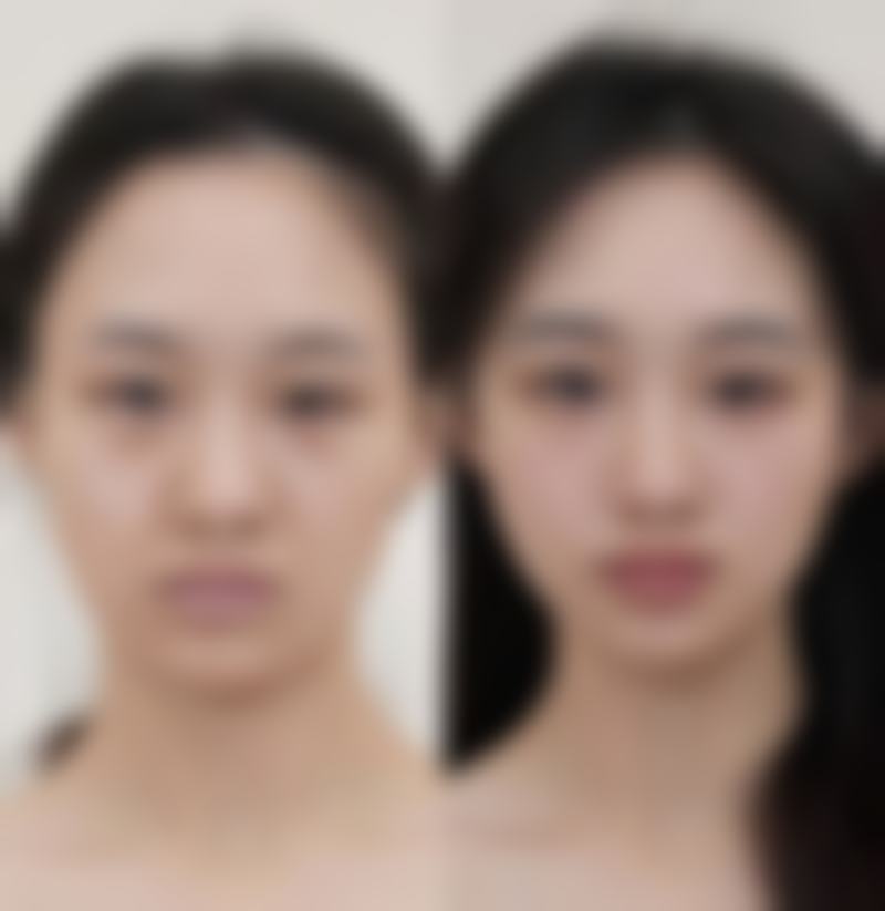 山东大学附属儿童医院求美者反馈