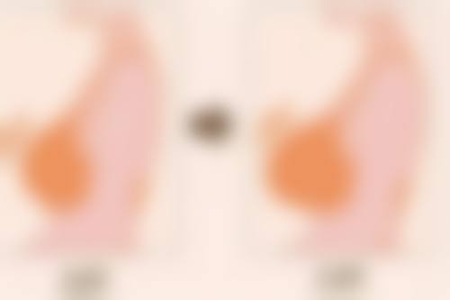 成都朗睿医疗美容价格收费
