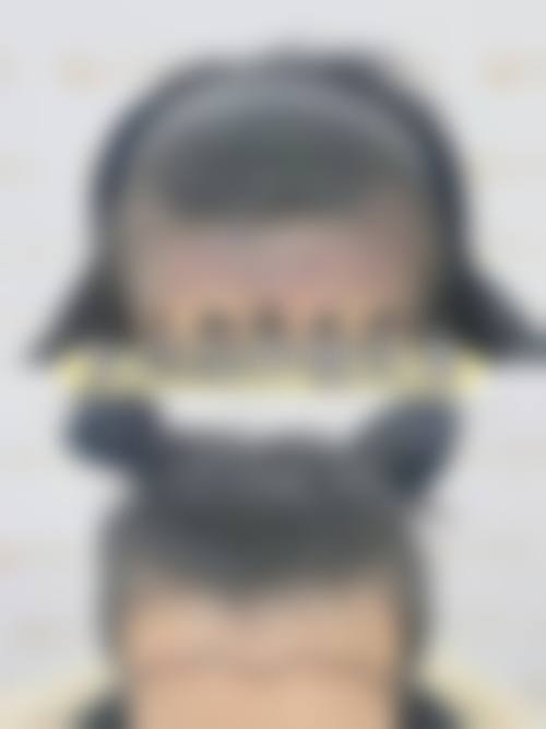 快速预约曾少林医生的面诊服务