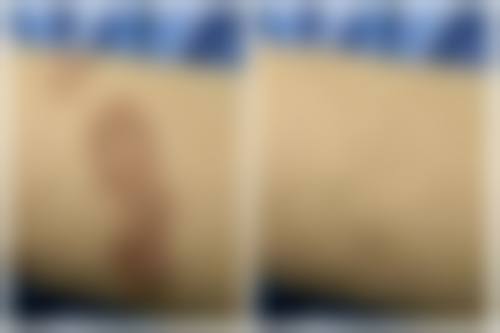 傅贤德医生：依托正规医疗配置，保护手术安心与成效