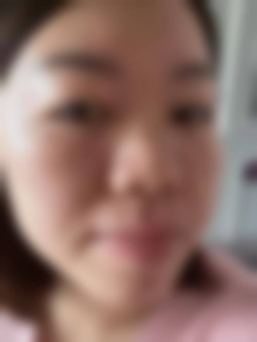 柳锡泰院长的多元塑形与修复专长