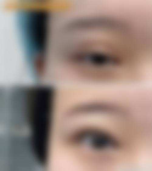 重庆康雅整形美容医院价格收费