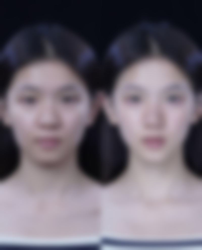 本溪朱丽华整形医院求美者反馈