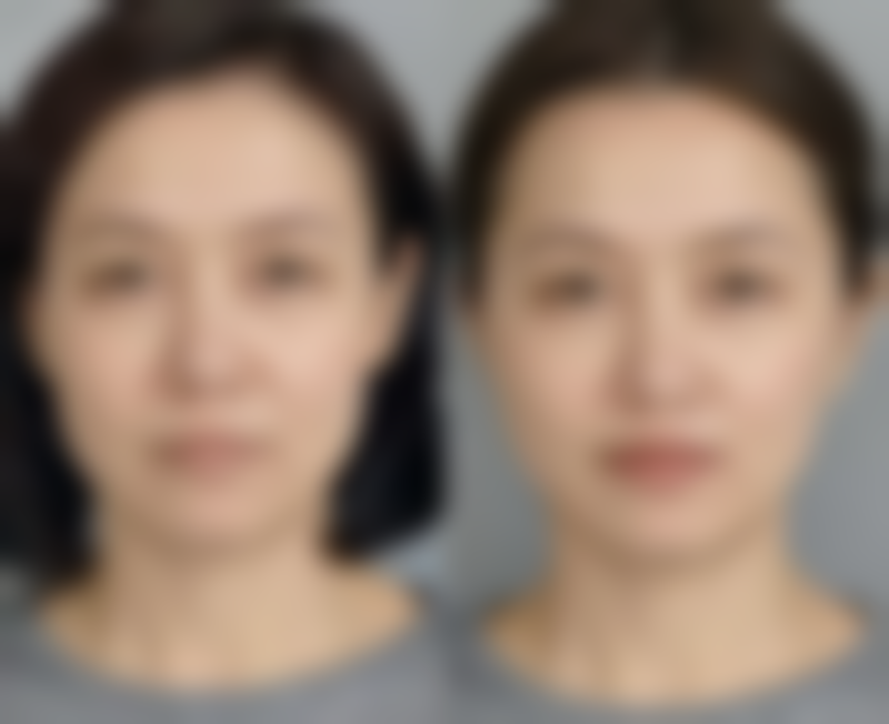 长春久诺美整形医院特色项目及技术优势