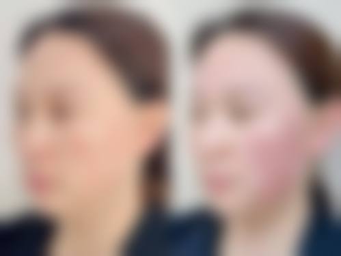 杭州芬迪医疗皮肤门诊部求美者反馈
