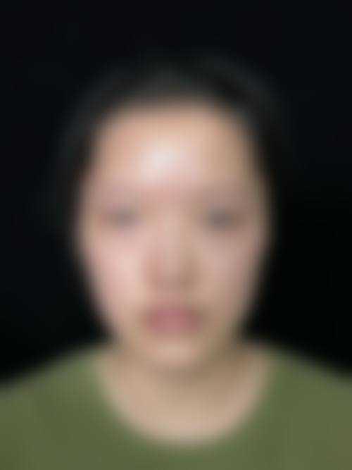中山伊美神医疗美容医院求美者反馈