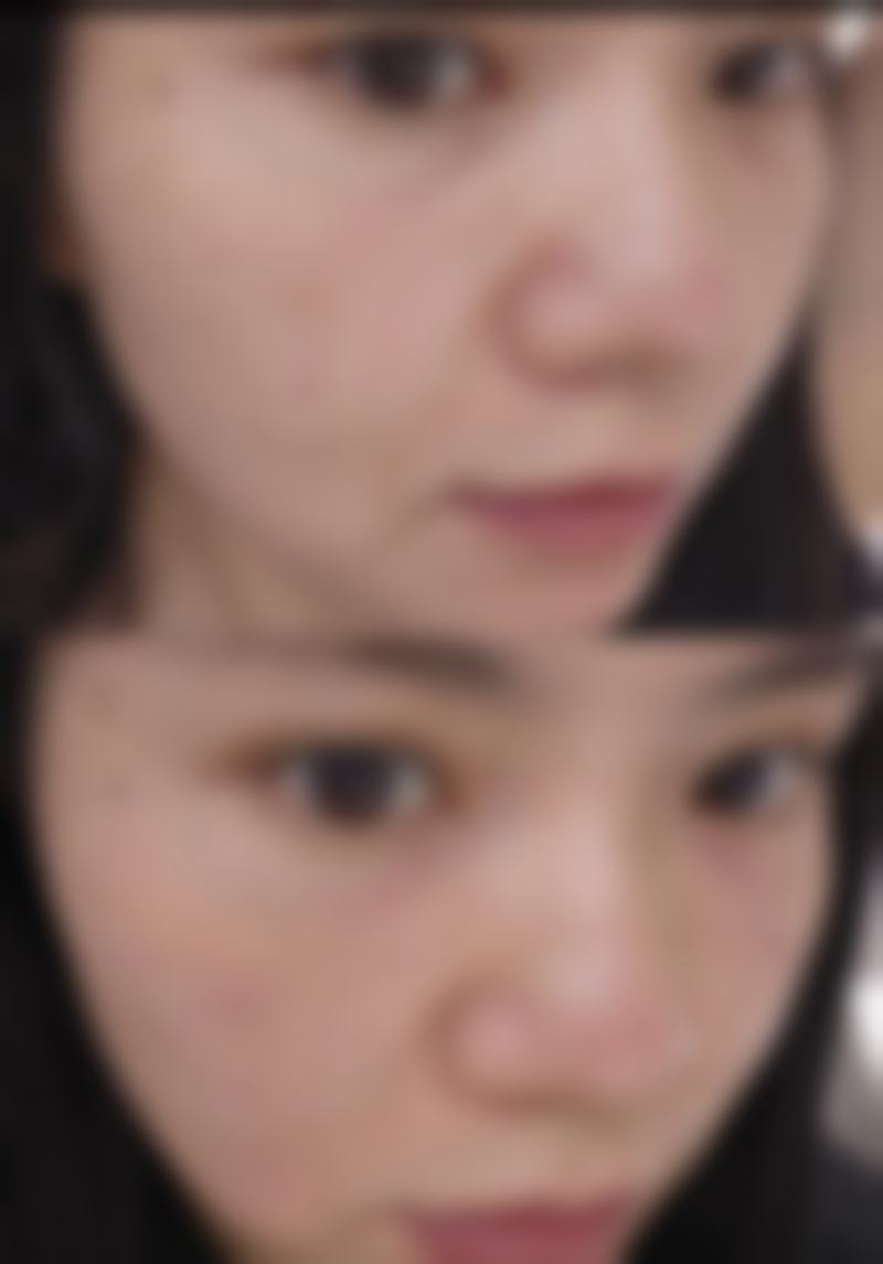 哈尔滨华美整形医院求美者反馈