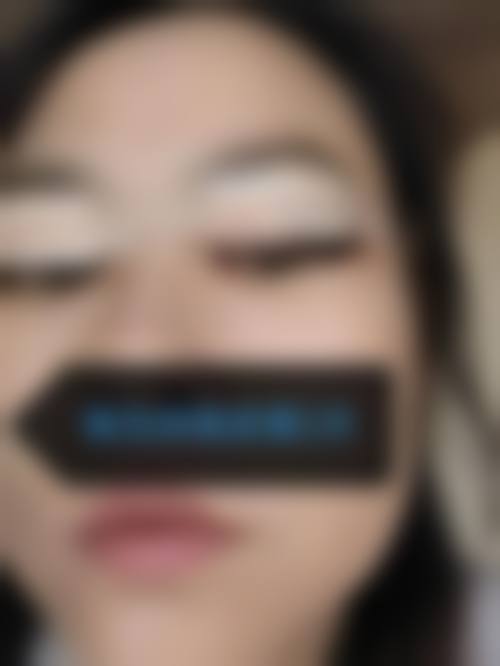 广州艺美医疗美容医院求美者反馈