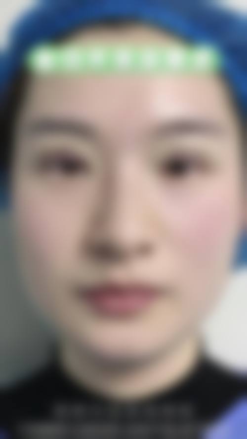 广州艺美医疗美容医院价格收费