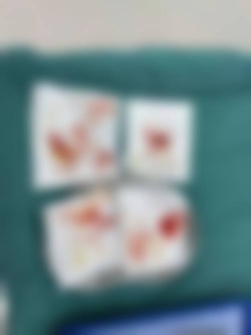 清远森语整形医院价格收费