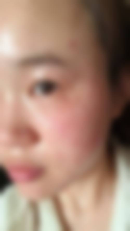 姚军 医生依托日照美丽华医院的专精平台开展诊疗