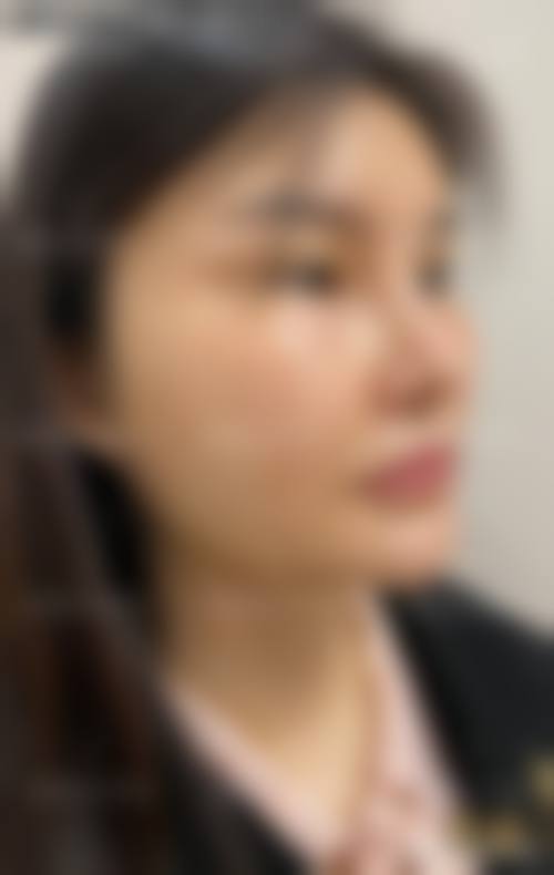九江汪海峰整形美容医院求美者反馈