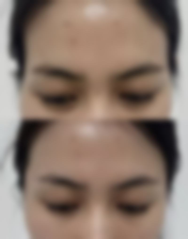 温州友好整形美容医院求美者反馈