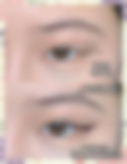 预约曹中侃医生就诊的便捷指引