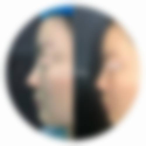 韩国褔莱泽pleasure整形外科特色项目及技术优势