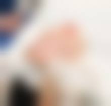 南京青春之泉医疗美容诊所求美者反馈