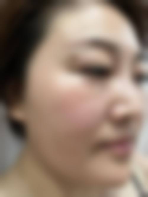 宋长海医生覆盖的全品类医美擅长项目