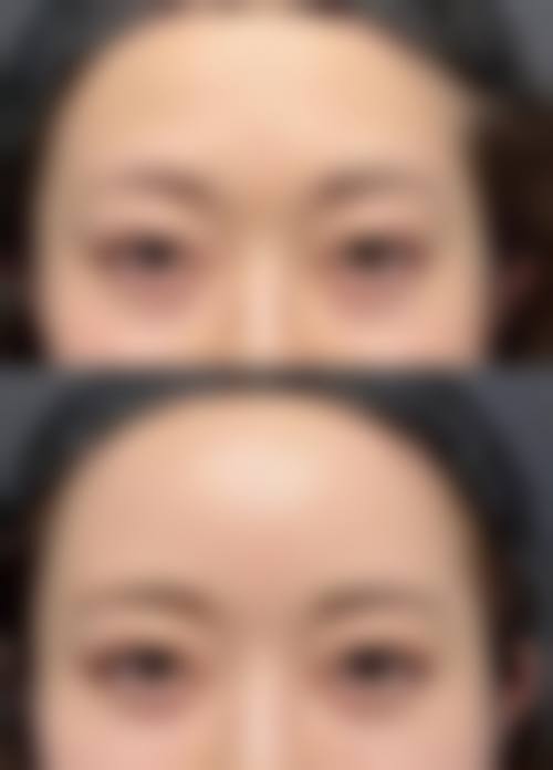 临沂玉婕医院整形美容中 心价格收费