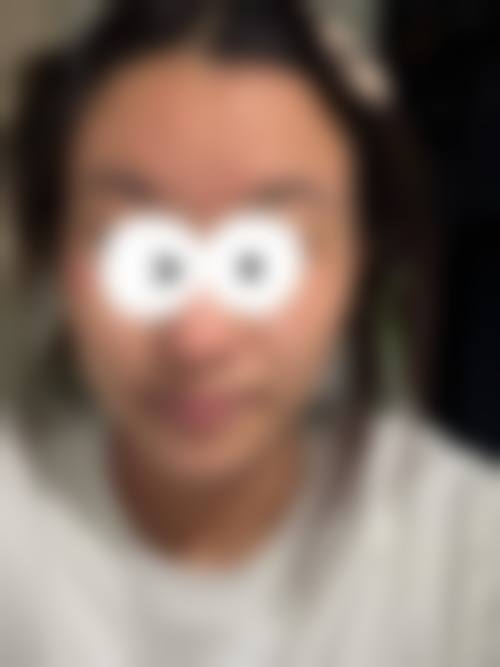 陈丽纯医生的安心医美保护体系
