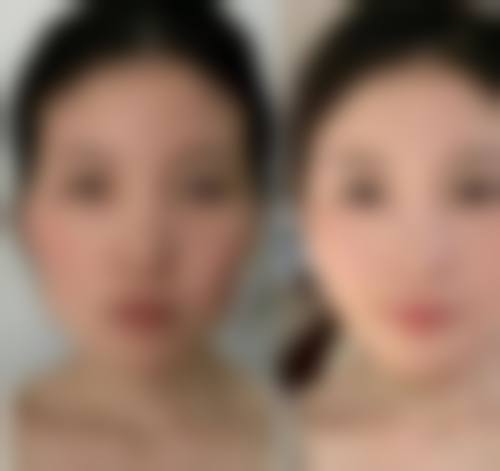 济宁任城壹美天成医疗美容医院价格收费