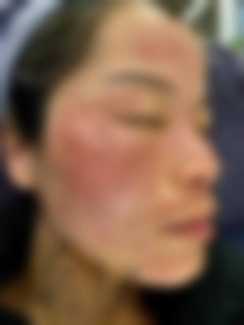 韩国human皮肤科首尔大店求美者反馈
