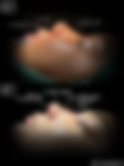 台州温岭达纳美医疗美容诊所求美者反馈