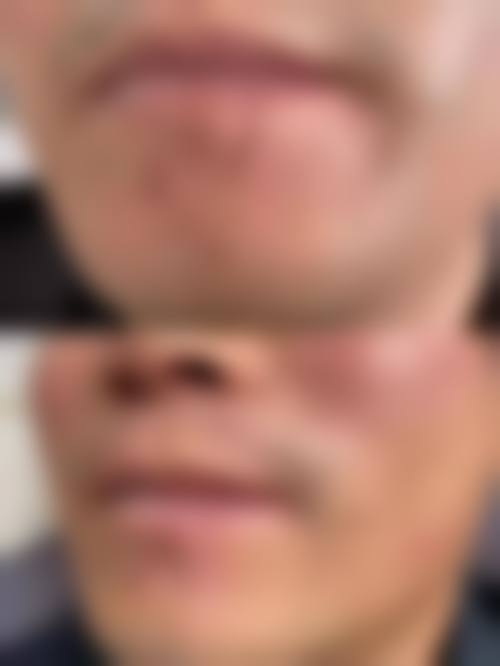 成都凯美鑫医疗美容医院特色项目及技术优势