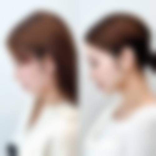 涿州高歌溢美整形医院价格收费