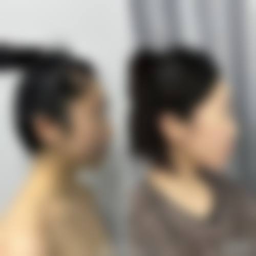 涿州高歌溢美整形医院求美者反馈
