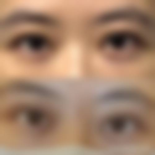 成都蓉美和谐医疗美容门诊部价格收费