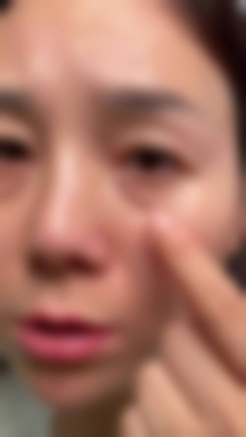 韩国Optima整形外科医院价格收费