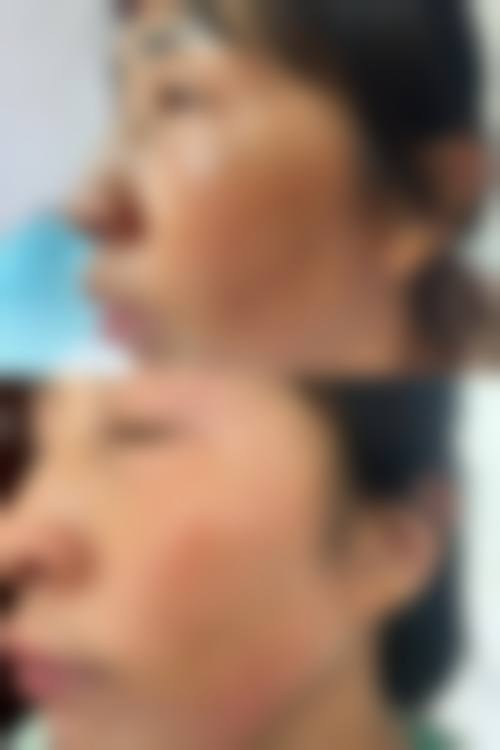 陈润茺医生的精良技术应用