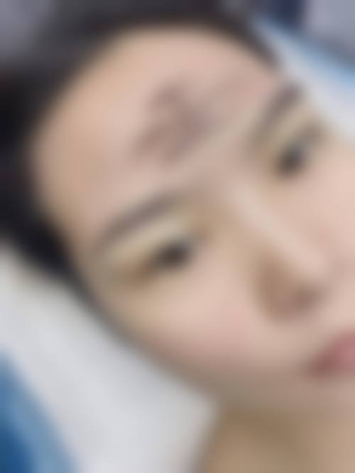 徐焰医生的安心医美服务标准