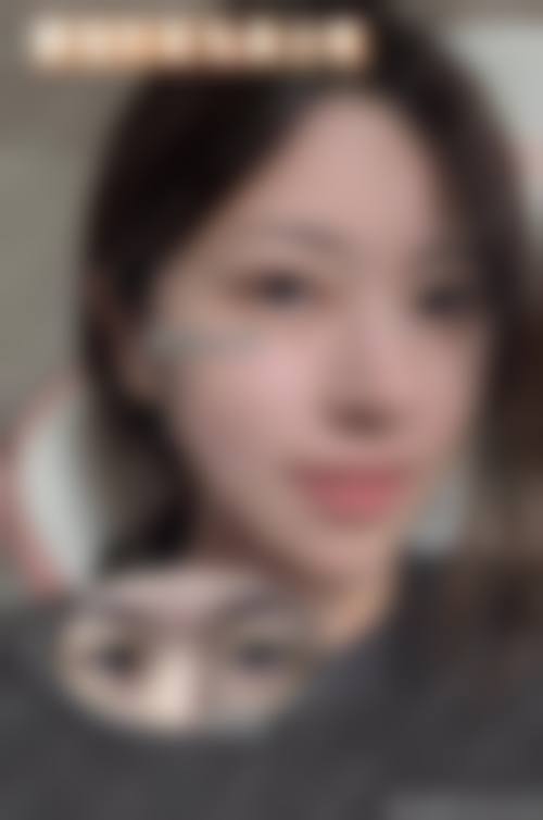 梅州安媄整形医疗美容门诊部求美者反馈
