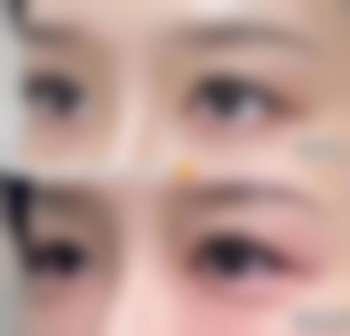 庄雅惠可开展的核心医美项目