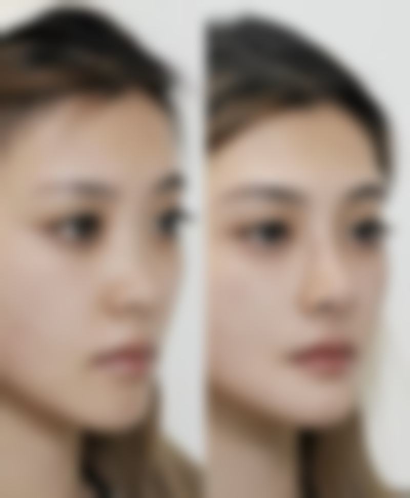 福州碧莲盛医疗美容门诊部价格收费