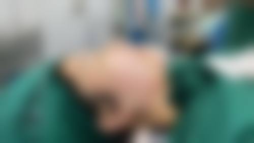 宁波白沙艺生美整形医院求美者反馈