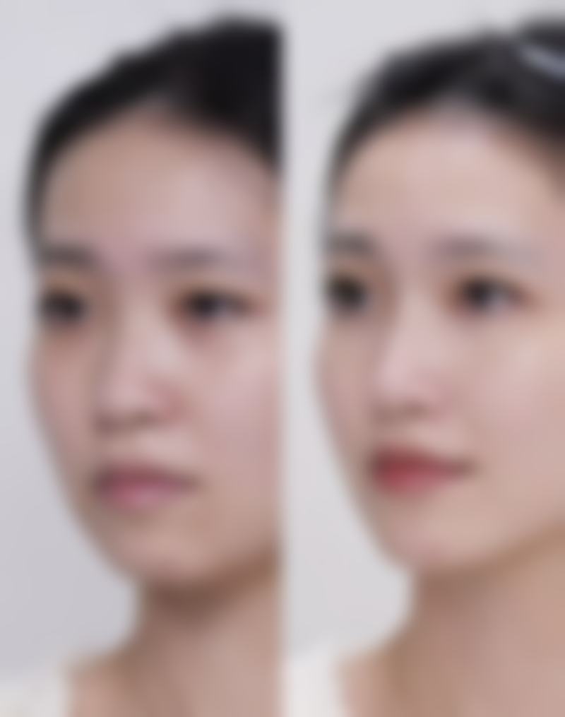 韩国克莱尔CLAIR整形外科求美者反馈
